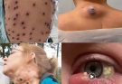 These are the signs that it’s gro…See More